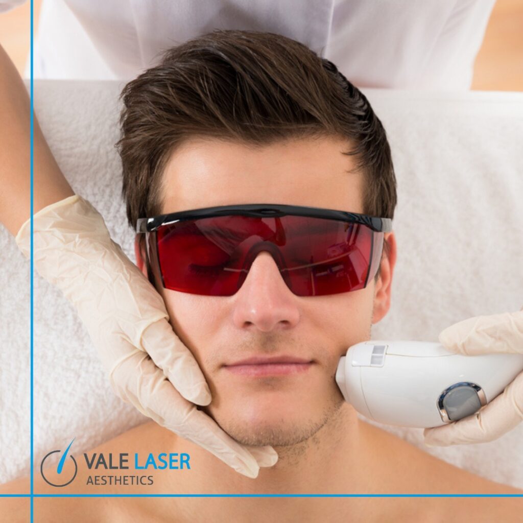 Cardiff Laser Hair Removal