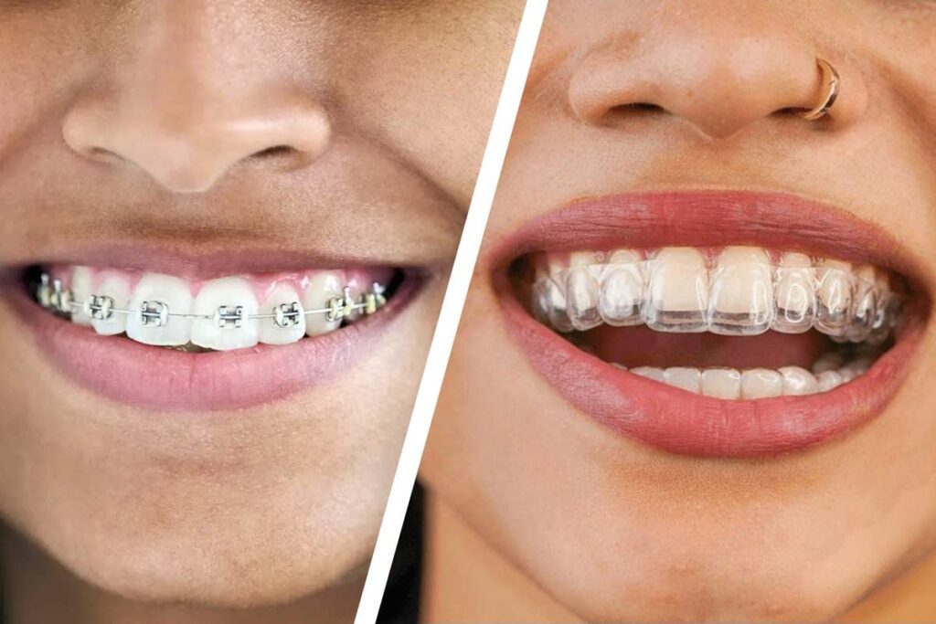 invisalign dentist near me